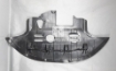 Picture of Hyundai Elantra 2021-2024 Engine Splash Shield